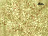 9 – Tetrasporocisti sparse alla superficie del tallo